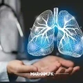 dr-sidla-pulmonologist-lung-specialist-lahore
