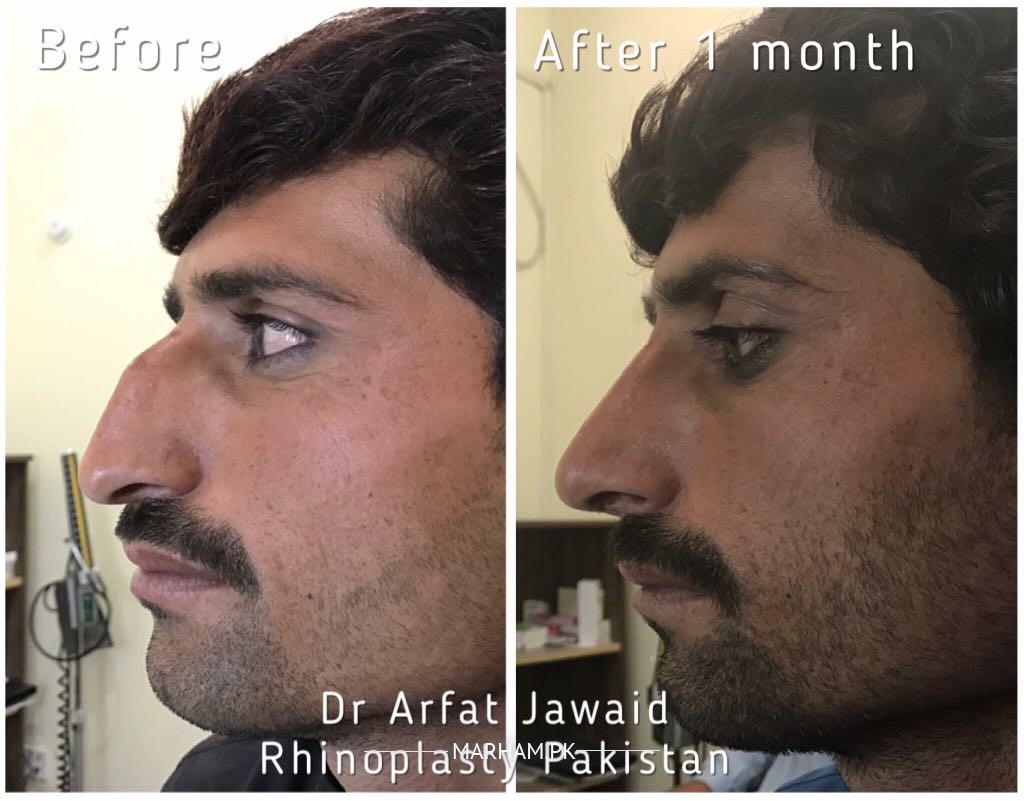Gallery Image of Dr. Arfat Jawaid