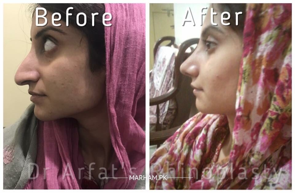 Gallery Image of Dr. Arfat Jawaid